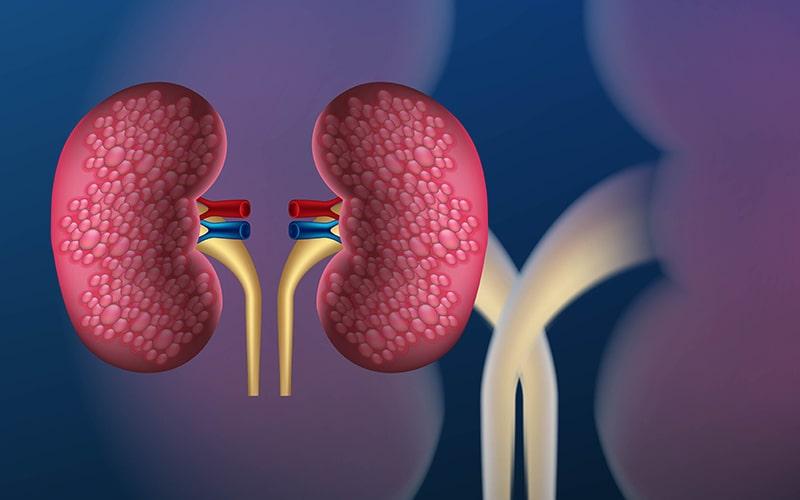 Kidney Disease Symptoms, Risk Factors & Treatment | Diseases List A-Z