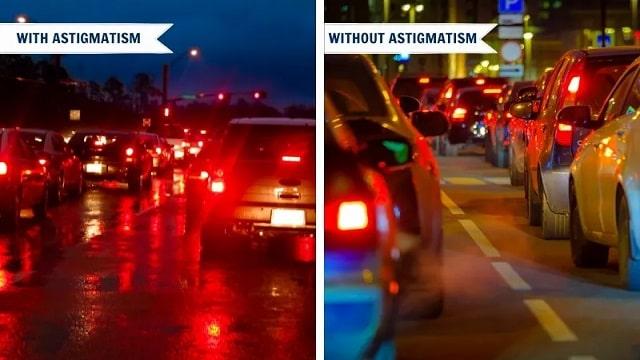 Astigmatism Symptoms, Risk Factors & Treatment | Diseases List A-Z