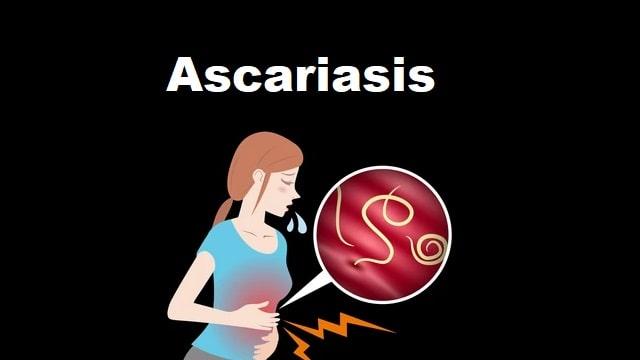 Ascariasis Symptoms, Risk Factors & Treatment | Diseases List A-Z