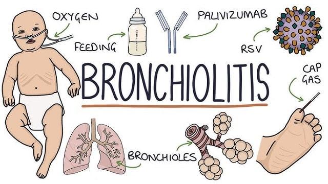 Bronchiolitis Symptoms, Risk Factors & Treatment | Diseases List A-Z