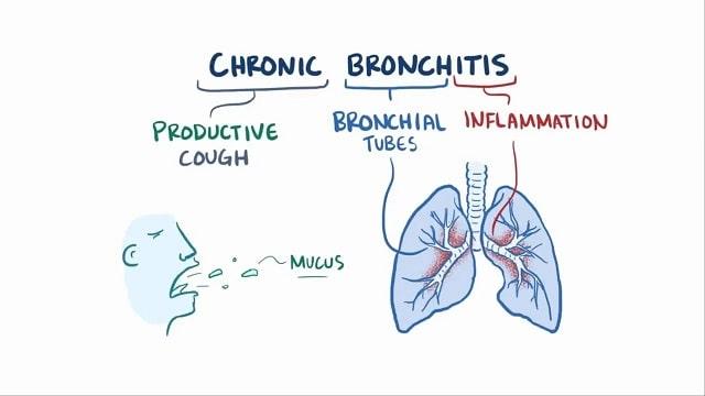 Bronchitis Symptoms, Risk Factors & Treatment | Diseases List A-Z