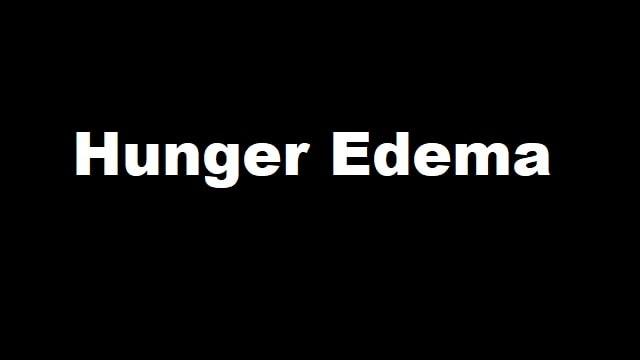 Hunger Edema Symptoms, Risk Factors & Treatment | Diseases List A-Z